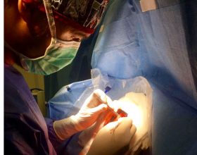 El Dr. De Quintana realiza la primera operación de paciente despierto en el Hospital CIMA