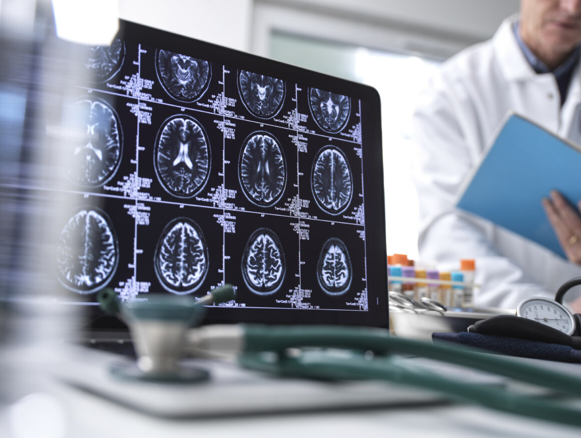 Dra. Alba Sierra - epilepsia Dra. Alba Sierra - epilepsia