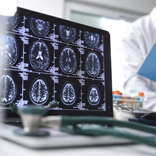 Dra. Alba Sierra - epilepsia Dra. Alba Sierra - epilepsia