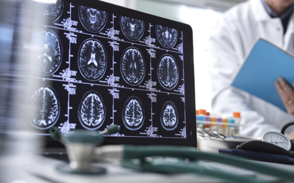 Dra. Alba Sierra - epilepsia Dra. Alba Sierra - epilepsia