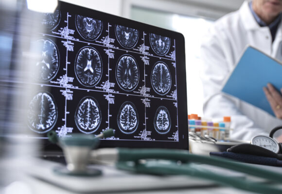 Dra. Alba Sierra - epilepsia Dra. Alba Sierra - epilepsia