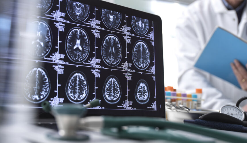 Dra. Alba Sierra - epilepsia Dra. Alba Sierra - epilepsia